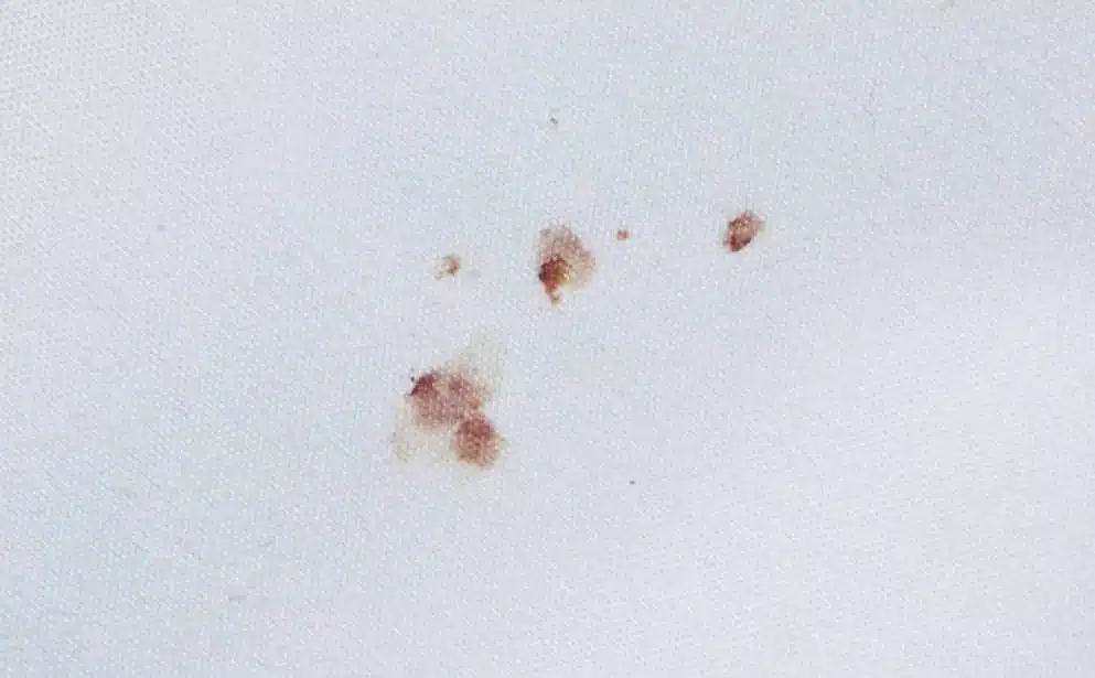 bed bug blood stains on sheets